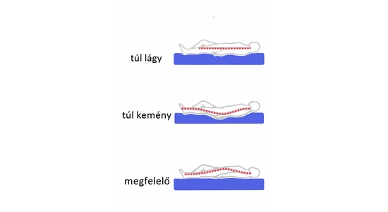 Szivacs matrac, kemény szivacs, puha szivacs, memory szivacs?